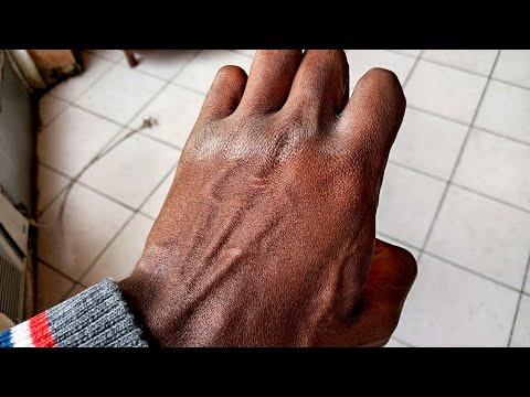 100 knuckle clapping push ups | Iron fist training | (Challenge revisit)