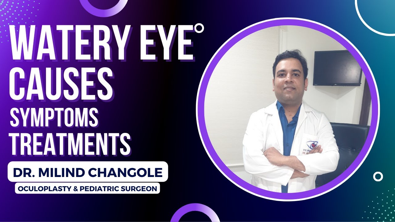 Watering Eye Causes, Symptoms, Treatment Dr. Milind Changole
