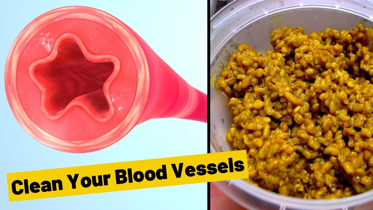 Cleanse Your Blood Vessels With Just One Glass Of This Drink YouTube