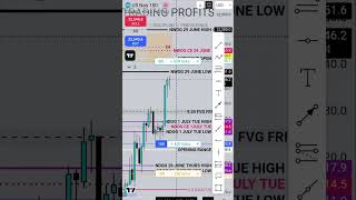 Nq Long At 930 Open Eq Low Sweep To 1H Sibi Ict Precision Trade