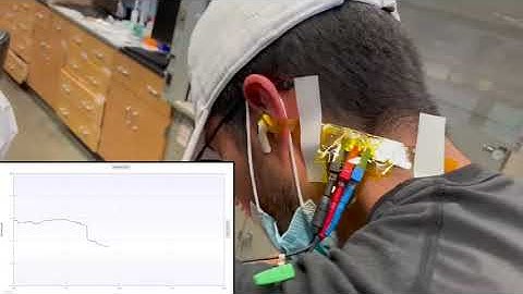 Screen-printed, flexible sensors allow earbuds to record brain activity and exercise levels