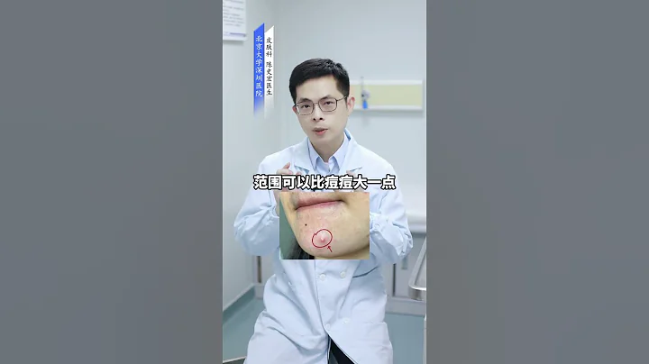 滿臉的痘印痘坑 比長痘更煩人！教你怎麼祛痘消痘印最有效 - 天天要聞