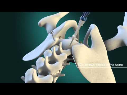 Open Zoomed Related Entry 3D Medical simulation