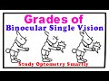 3 grades of binocular vision