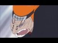 My Pain is Still Far Greater Than Yours! (English Dub)
