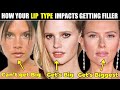 Is your lip type a good match for filler how your lip type impacts getting lip filler