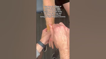 TFCC Taping #taping #physiotherapy #physio #physicaltherapy #wristinjury