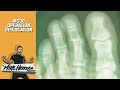 Episode #538: Operation Dislocation