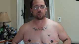 Top Surgery Reveal! 7 days Post Op Profile
