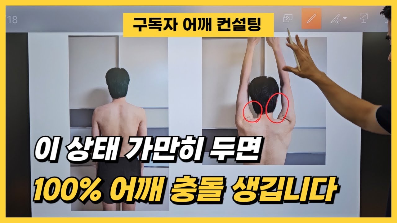 [구독자 어깨 컨설팅] 이대로 가면 어깨 충돌 100%입니다