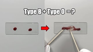 What Happens When Two Different Blood Types are Mixed Together?