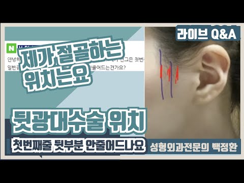 뒷광대 수술시 위치문제로 질문드립니다.