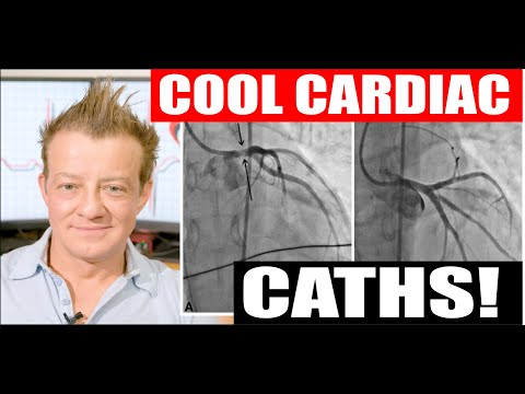 Two Unusual Cardiac Cath Cases