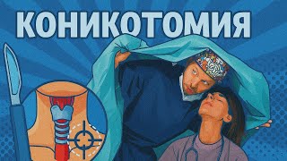 видео: Коникотомия (крикотиреотомия) картинка: Коникотомия (крикотиреотомия)