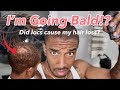 Did Dreadlocks Cause My Alopecia Areata?!😱🤯 | Trying Toppik Hair Fibers😣😓 #dreadlockjourney
