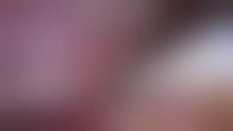 ICG right sentinel biopsy by Prof. N. Vlahos