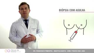 Vácuo cirurgia a