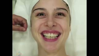 Boncuk Ağda Kullanım Örneği