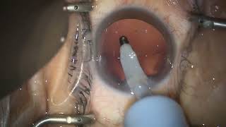 24.05.30 M.63 Od 81463