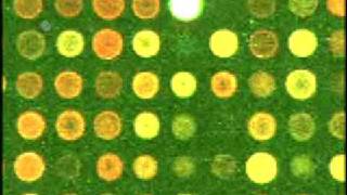 Faculty Interview | MIT Introduction to Bioengineering, Spri