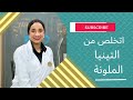 اتخلص من التينيا الملونة علاج تينيا الفخدين تينيا القدمين