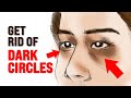 What Causes Dark Circles Under Eyes? – Dr. Berg Mp3 Song