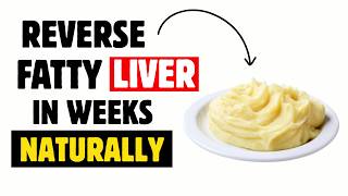 The FASTEST Way to Reverse Fatty Liver | Dr Megan Foster