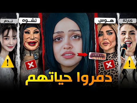مشاهير دفعوا ثمن عمليات التجميل الفاشلة 5
