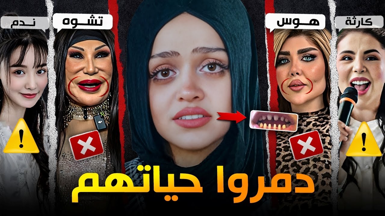 أفشل عمليات تجميل دمرت المشاهير #5
