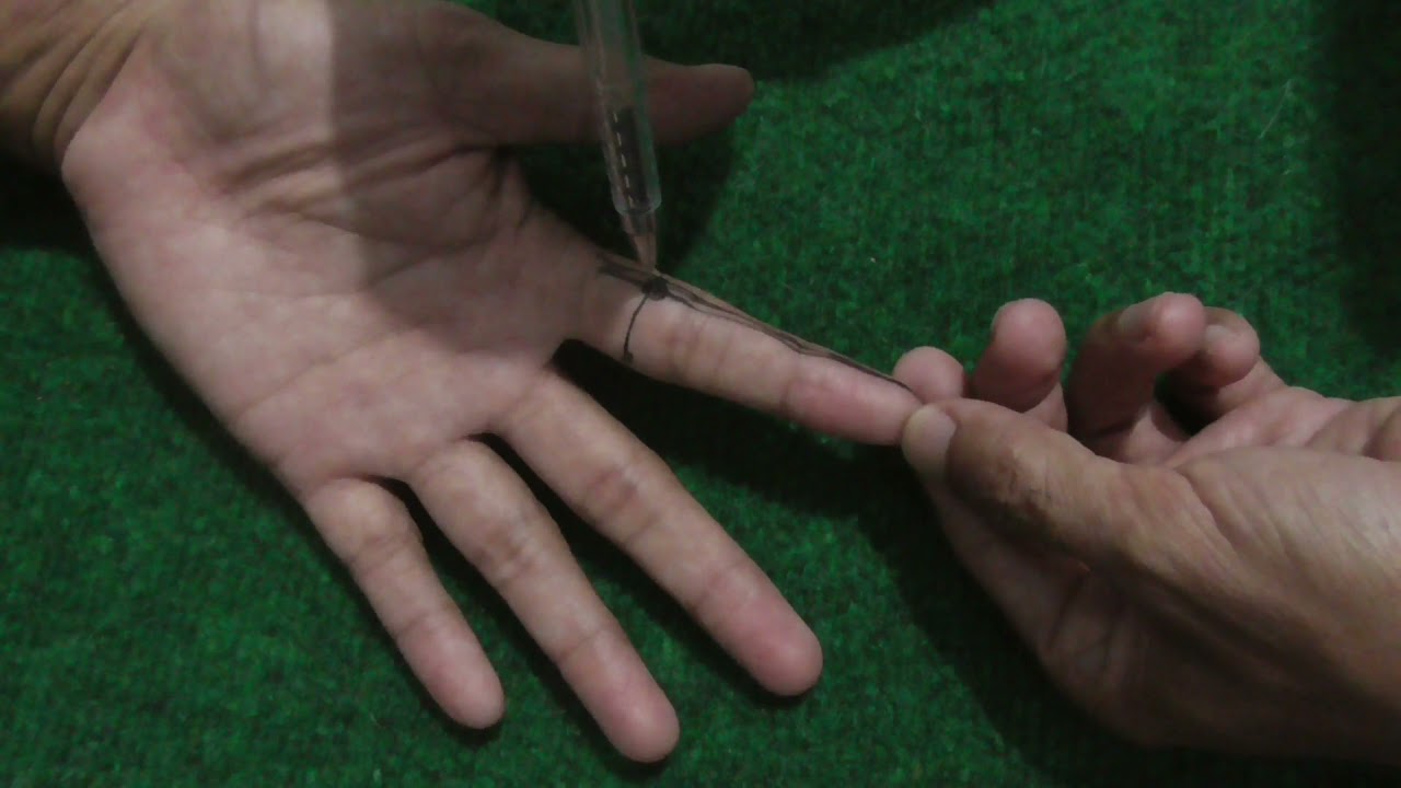 Titik Akupuntur Master Tung - Dajian (T 11.01)