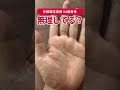 【手相実例】無理しがちな人に出るサイン #shorts #手相