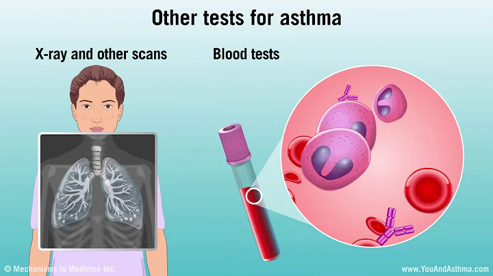 Diagnosing Asthma: Mild, Moderate and Severe - DayDayNews