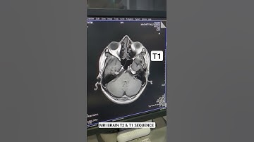 The Science of Seeing Inside Your Head