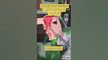 طريقة ازالة لحمية عنق الرحم المسببة للنزيف المهبلى اثناء الجماع د فاطمة التركى استشارى النساء 
