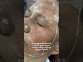 🥇 “She Came With Deep Pigmentation… Here’s What We Did 💄✨” #Shorts #makeupartist #pigmentation