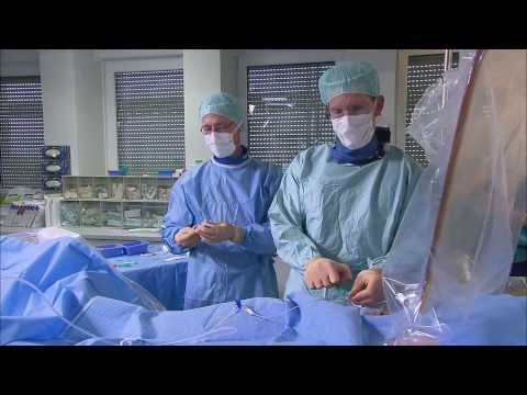 CSI 2013 -- Case 15 Frankfurt - video from Occlutech