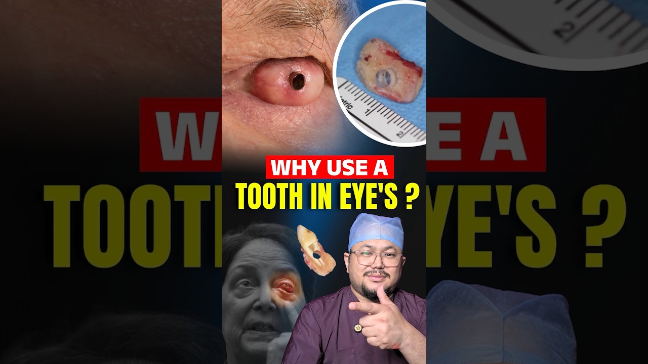 Why Do Doctors Use a Tooth in Eye Surgery? 😳 Real Science Explained