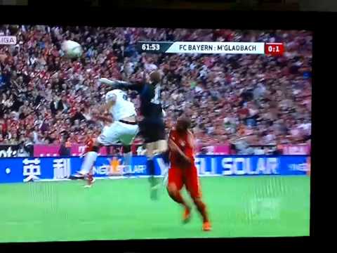 Bayern München - Mönchengladbach 0 1 Igor De Camargo Tor !!! Manuel Neuer Fehler Patzer