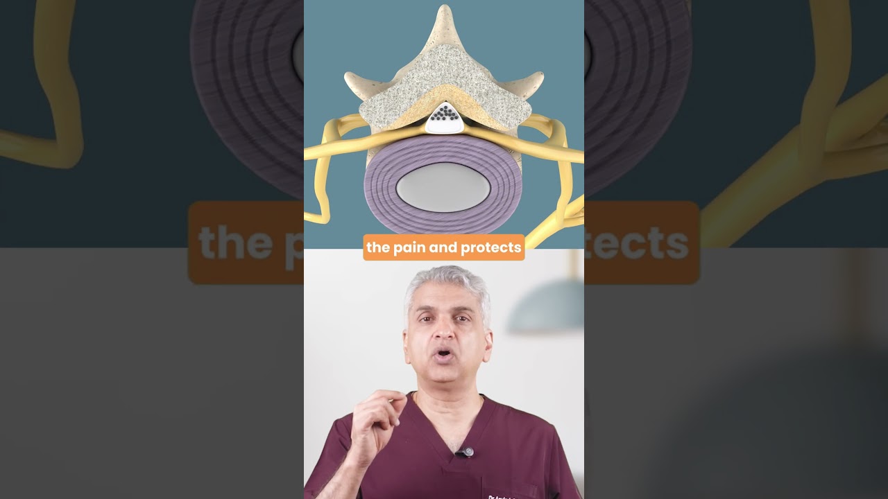 Endoscopic Spine Surgery for Herniated Discs: Explained 
