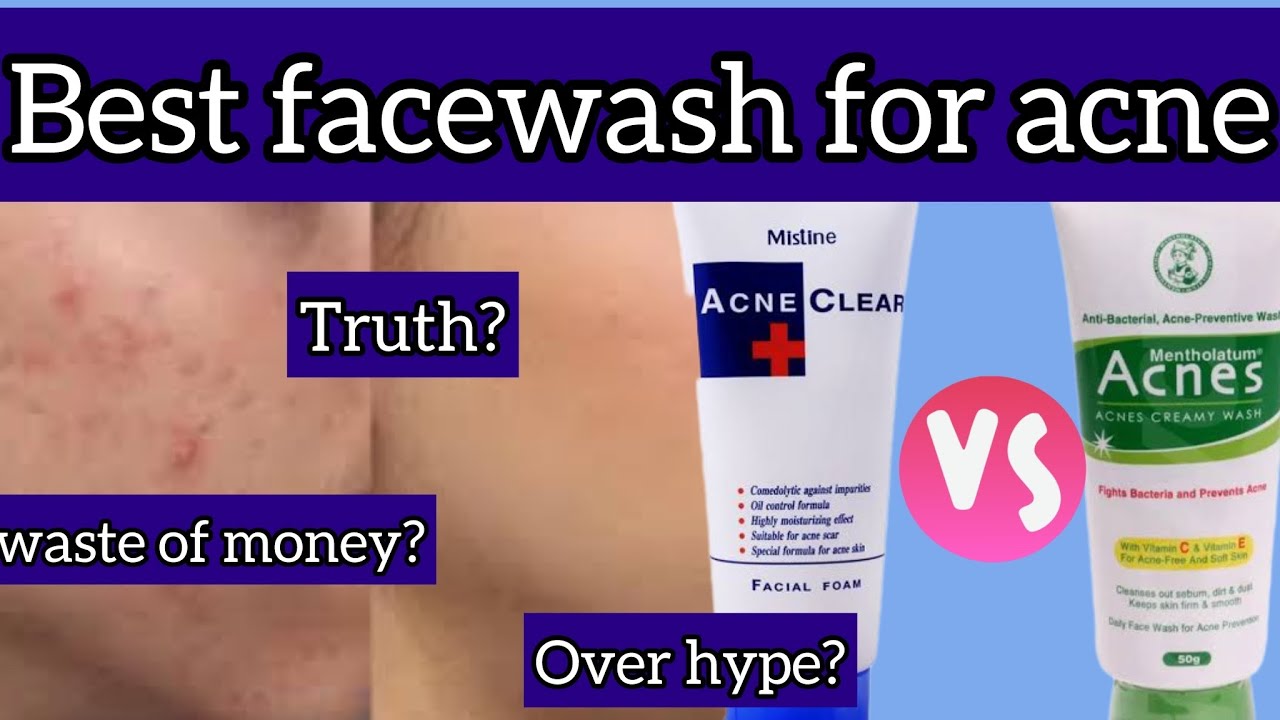 Mentholatum acnes face wash Vs Mistine acne clear face wash YouTube