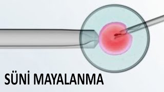 Əkiz, Üçəm Doğmaq Üçün - Di̇qqətlə Baxın