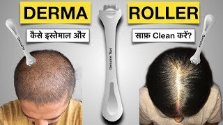 How to Use and Clean Derma Roller to Stop Hair Fall ? When to Use , Which Needle ? For Men and Women