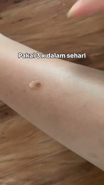 Koreng masih aktif pakai ini aja #fyp #korengan #penghilangbekasluka #koreng #darahmanis