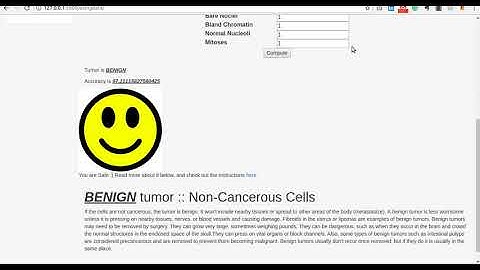 Breast Cancer Detection