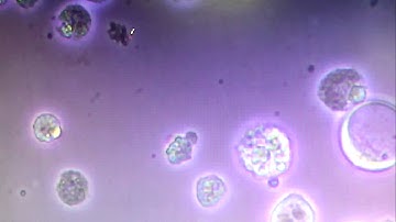 Cell culture contamination (need help to verify)