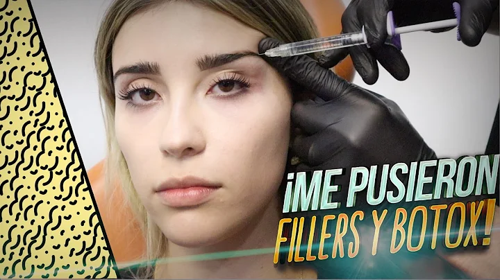 ME PUSE BOTOX Y FILLERS  | @Priscila Escoto