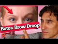 BOTOX BROW DROOP - Brow Tutorial