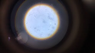 Death of a ciliate.