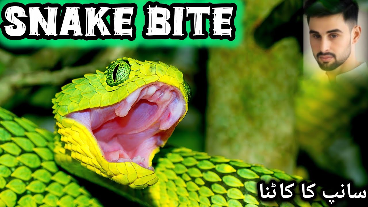 Snake bite 3D animation | dangerous |fatal |signs |prevent?