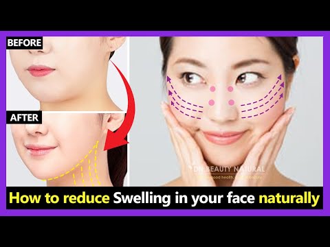 How to reduce swelling face, face bloating quickly & slim down Puffy face naturally | Facial massage